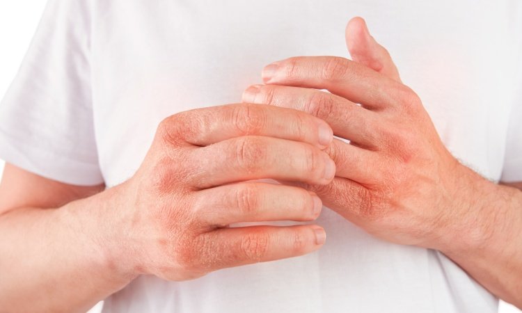 Nahaufnahme von den Händen eines Mannes, welcher sich mit einer Hand an der anderen Hand berührt